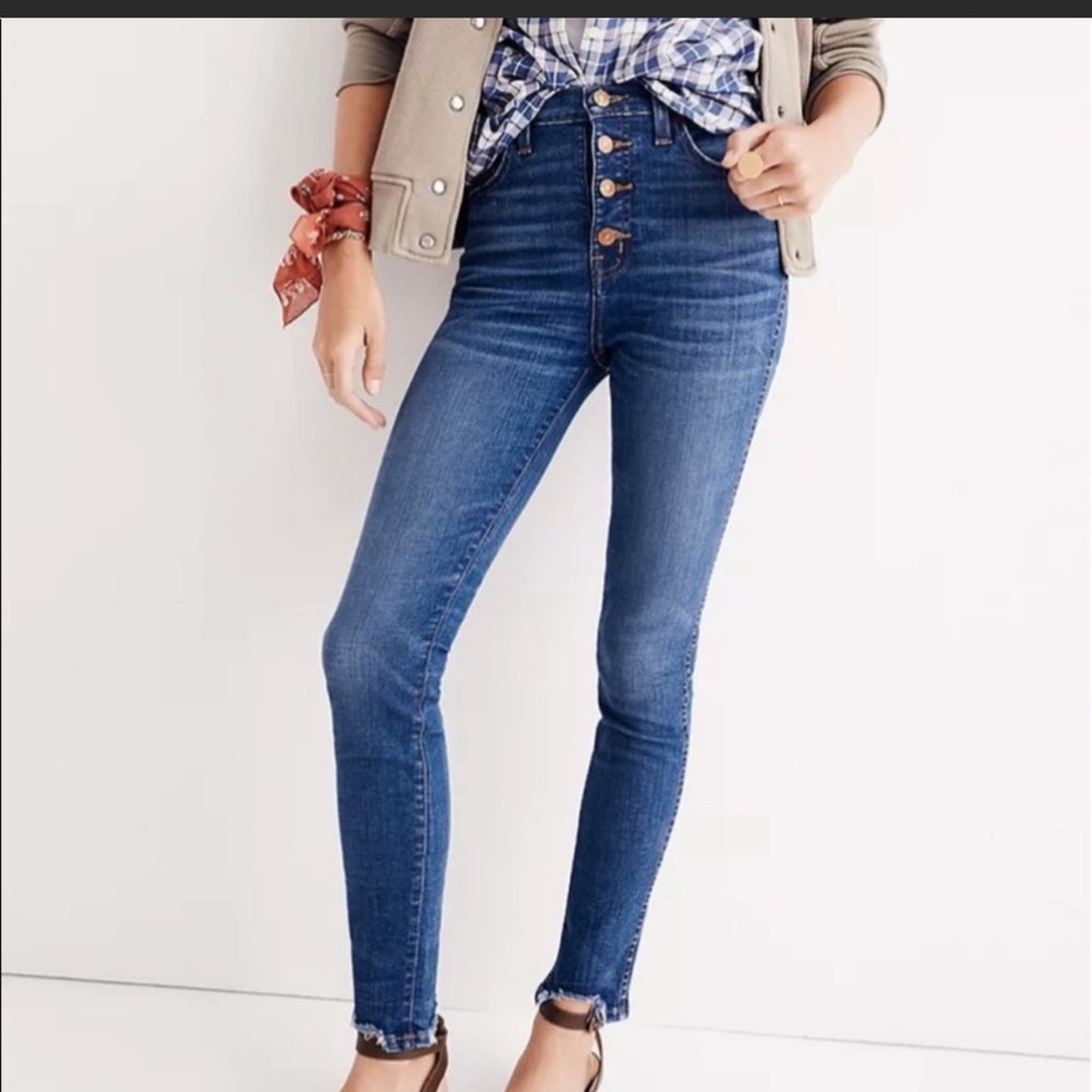 Madewell 10” Rise Skinny Distressed Button Fly High Rise Jeans
